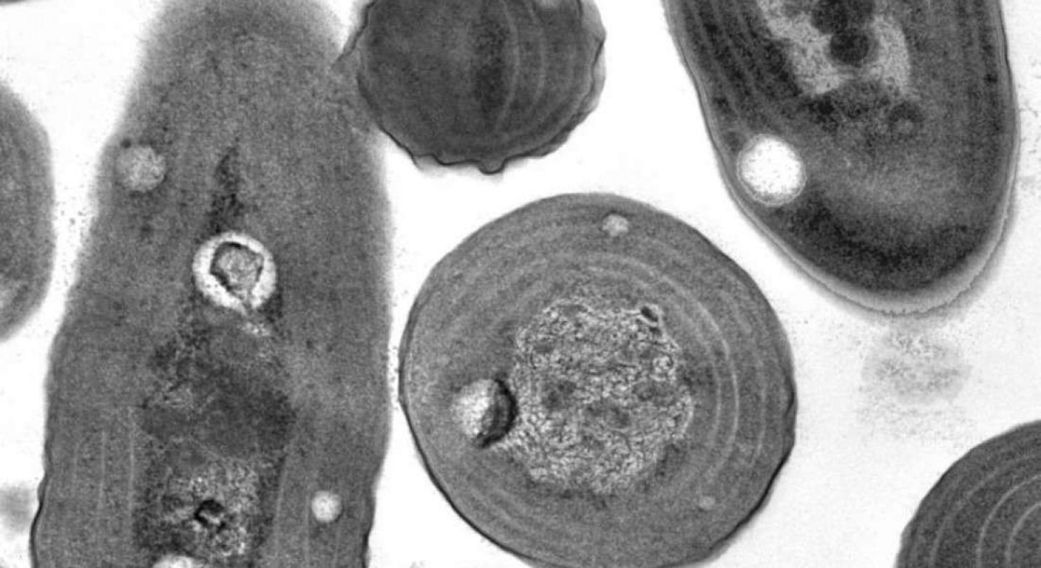Самая древняя клетка. Окаменевшие цианобактерии. Первая клетка. Самая Старая бактерия. Окаменевшие бактерии.