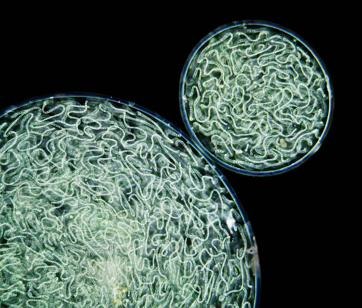 Бактерии и углерод. Цианобактерии Nostoc. Цианобактерии колония ностока. Цианобактерии сине-зеленые водоросли. Микроорганизмы цианобактерии.