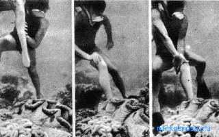 Нога — Сонник Хассе Нога — Сонник Хассе