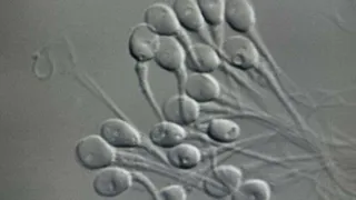 Поездка на Марс может лишить астронавтов возможности иметь детей