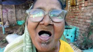 В Индии живет старушка, которая есть ежедневно 1 килограмм песка