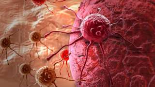 Новый метод борьбы с онкологией: превращение раковых клеток в здоровые
