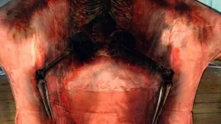 Самовозгорание человека