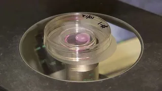 Австралийские ученые вырастили почку в лаборатории