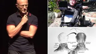 Ученые совершили новый шаг, приближающий операцию по пересадке головы 