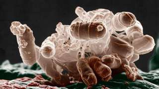Внеземные бактерии смертоносны для человечества 