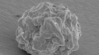 Российские ученые смогли вырастить костную структуру в условиях невесомости.