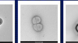 Жизнь после удара: Бактерии, выживающие в космосе, и теория панспермии