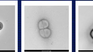 Жизнь после удара: Бактерии, выживающие в космосе, и теория панспермии